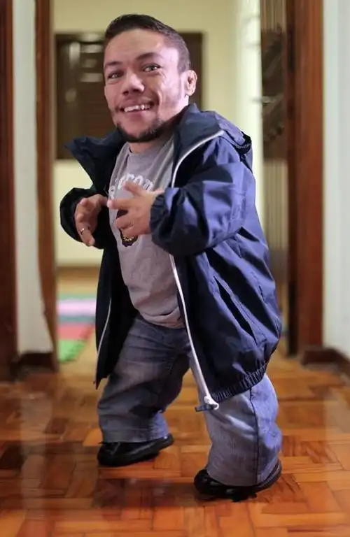 与一般的夫妻不同的是他们两个人都侏儒症患者,他们的身高都不足1米