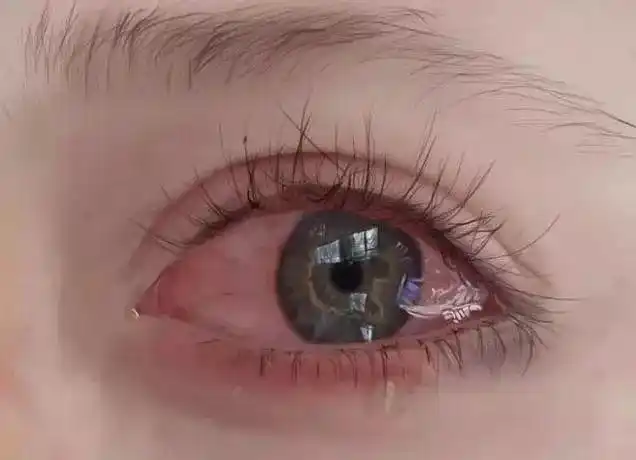 哪只眼睛刚哭过测出你这些年受过的委屈