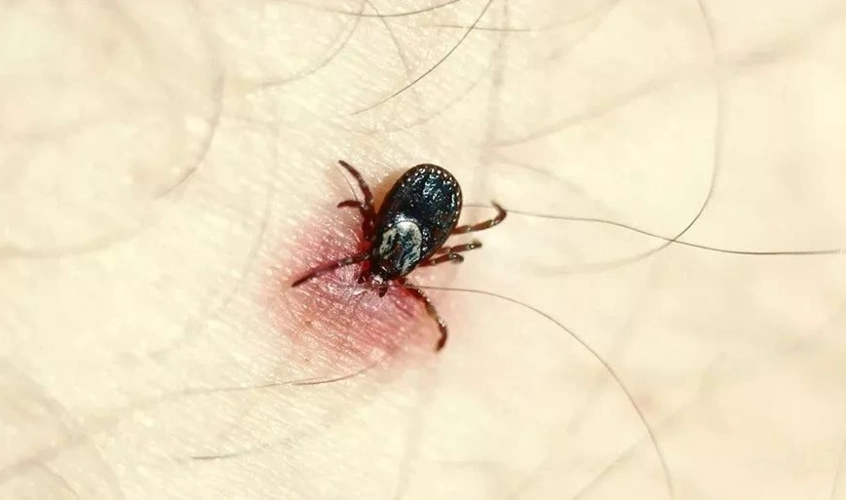 什么是蜱虫?和臭虫很像?