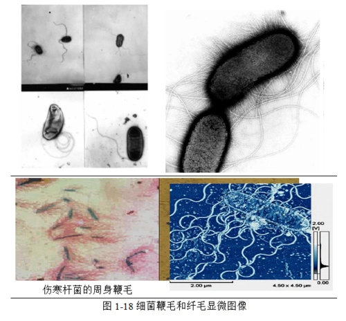 一层厚度不定的胶状物质,它犹如穿在菌体表面的一件外套,用显微镜观察