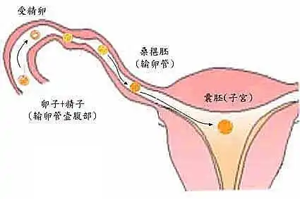 输卵管堵塞怎么办 得了输卵管堵塞怎么办