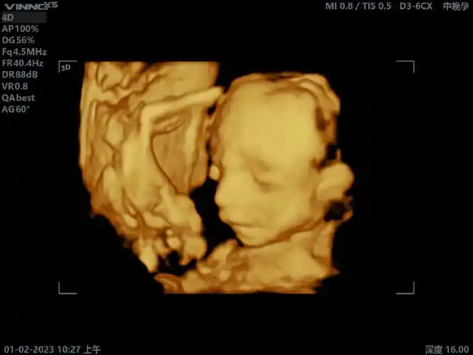 了阳康了旅游和爬山也与我无缘了还有四个月时间再坚持一下#双胞胎