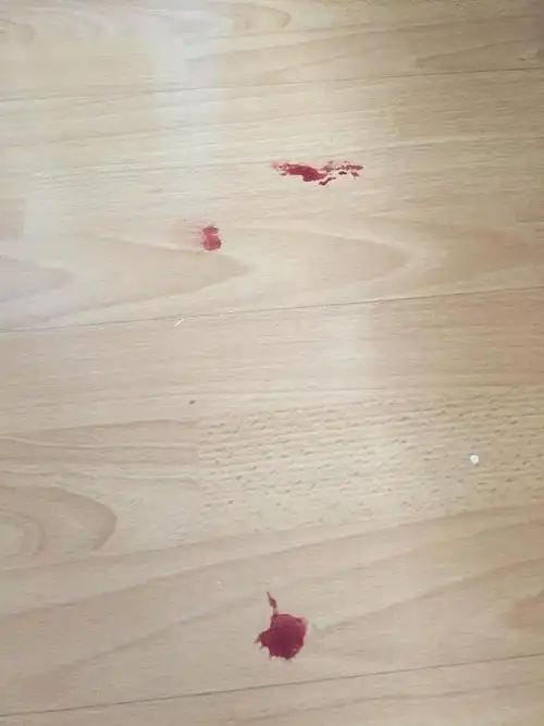 地板上的血迹