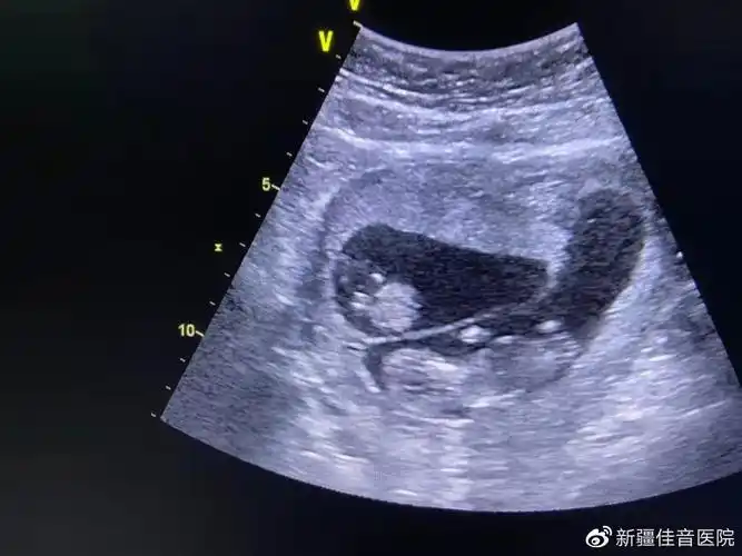 佳音故事9年我终于成了李焕英