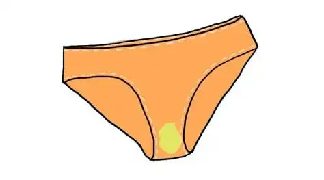 成都金牛真爱医院:警惕这七种白带异常情况_阴道_分泌物_臭味