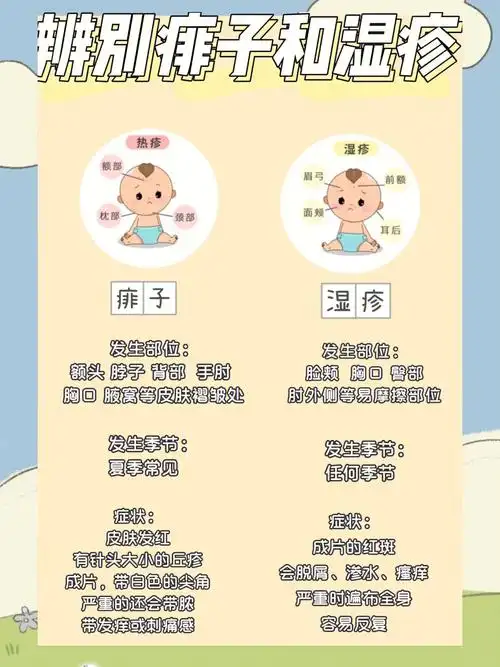 正确区分湿疹和痱子