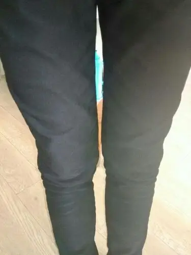 为什么我的小腿往外歪