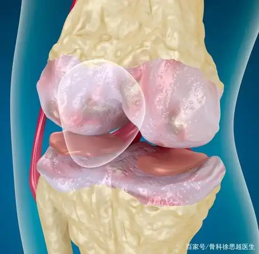 保护膝关节有个"黄金期",及早干预,延长膝盖的"寿命"