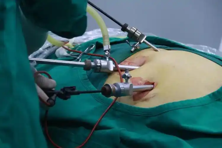 新密人你还在用传统手术方法治疗疝气吗微创的伤口这么小