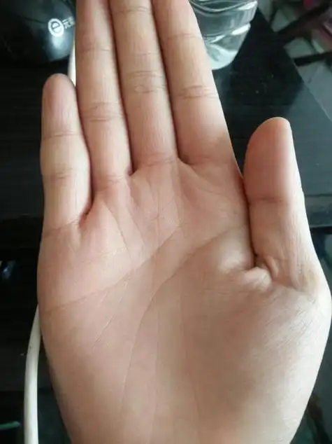 女,右手手掌两条事业线,有一条分叉到无名指下,另一条事业线和生命线