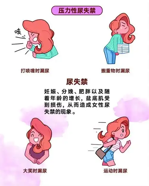 尿失禁图示1.jpg