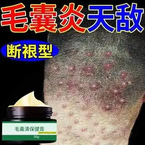 专治毛囊炎洗发水