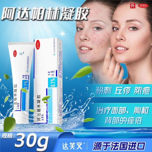 达芙文 阿达帕林凝胶 30g 粉刺丘疹和脓疱寻常型痤疮的皮肤治疗