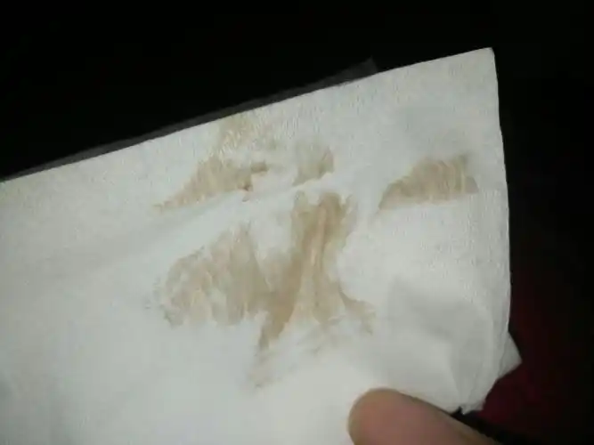 怀孕初期出血了,有图_百度宝宝知道