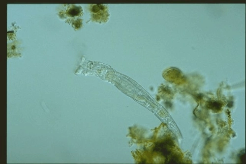 污水处理常见微生物照片