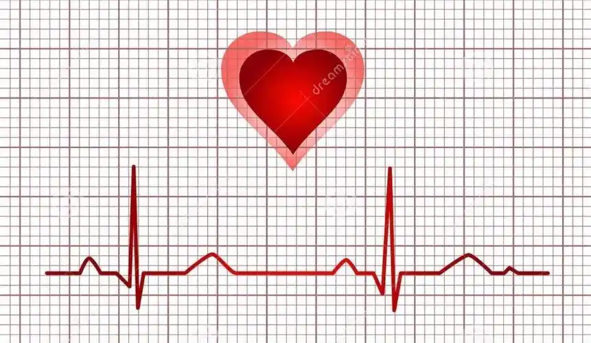 急性心肌梗死的"正常心电图"都有哪些情况