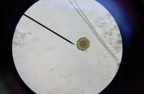 卵子是什么颜色卵子是什么颜色卵子是什么颜色