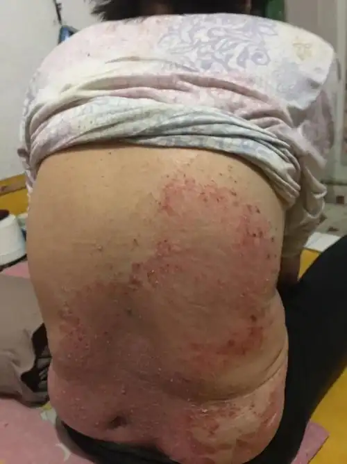 用了半个月的时候 背部