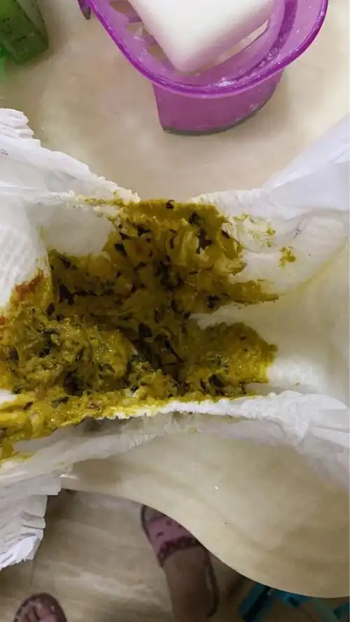 答 宝宝拉绿大便,一般是受凉引起的,还有消化不良也会引起的,宝宝要