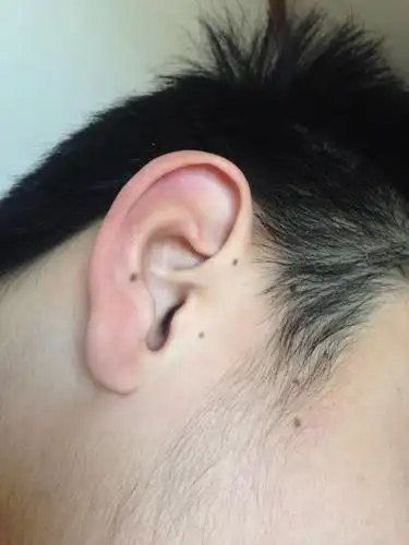 为什么耳朵这里出了很多黑点,怎么消除?