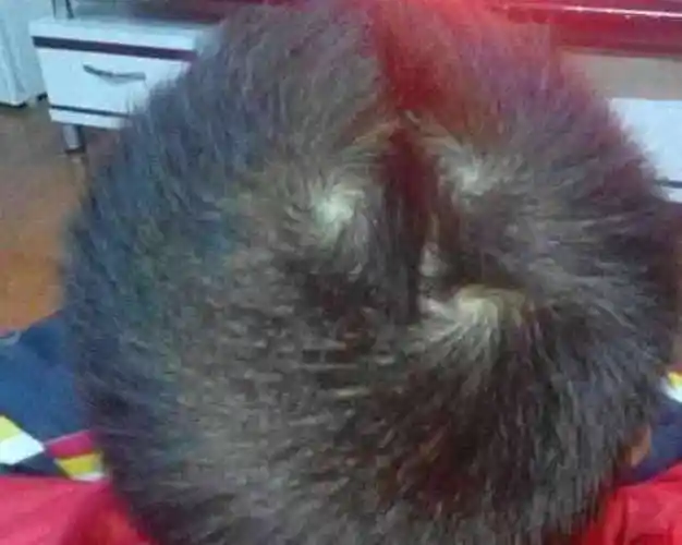 为什么有人头上只有一个旋,有人却有两个?看完才知误会大了