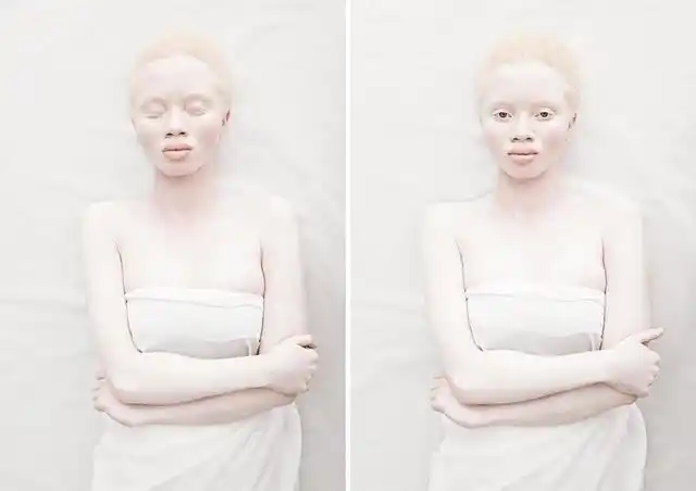 别样之美 欣赏一下这组白化病人的唯美写真