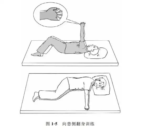 康复| 早期肢体功能训练2