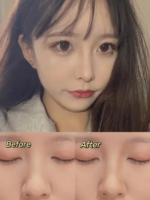 有手就行系列整容级鼻影教程告别肉鼻