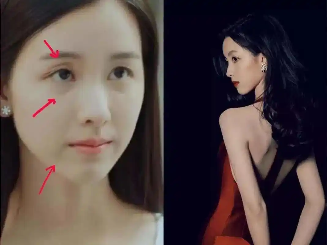 念自然科普:面部"三八线"特显老,看看你中招了吗?