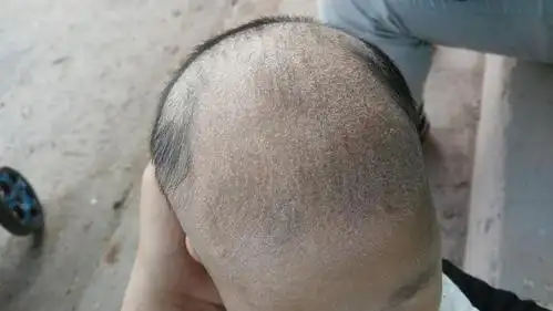 宝妈求解啊 宝宝的头上有一层白色的皮 干干的 还掉 急急