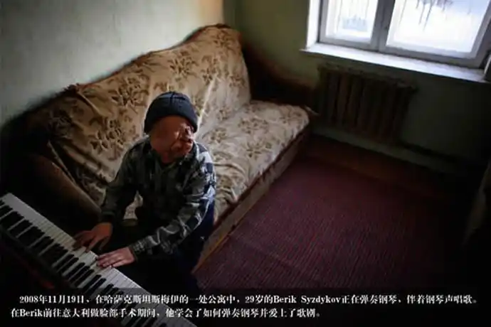 组图人被核辐射后的畸形惨状