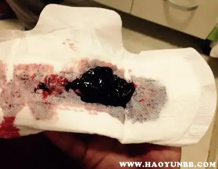 恶露排出一坨果冻似的血块正常吗