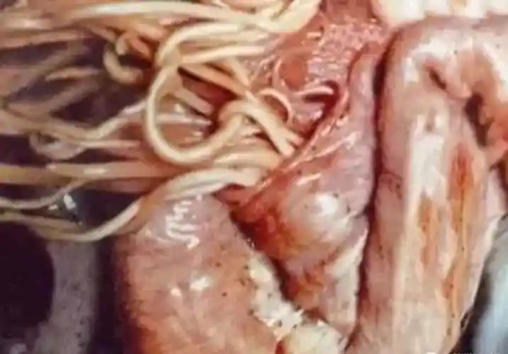 【技术】猪寄生虫病的症状是什么?如何防治?