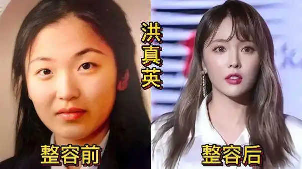 18位韩国女星整容前后对比