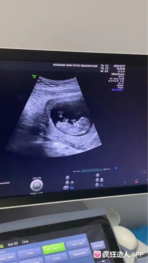 研究nub理论,nt图发来帮看男女,必回