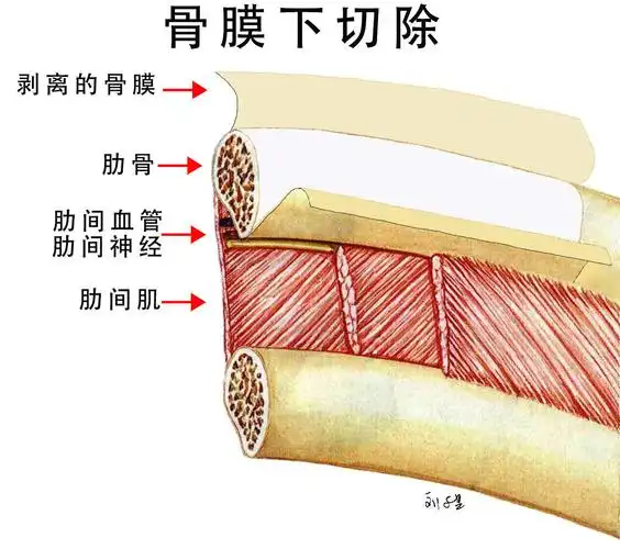 再次,被完整保留的肋软骨骨膜是一层致密的纤维结缔组织,容易在x光片