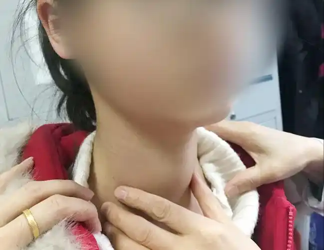 诗诗妈妈发现女儿的脖子好像肿起来了,但却不知道是什么病