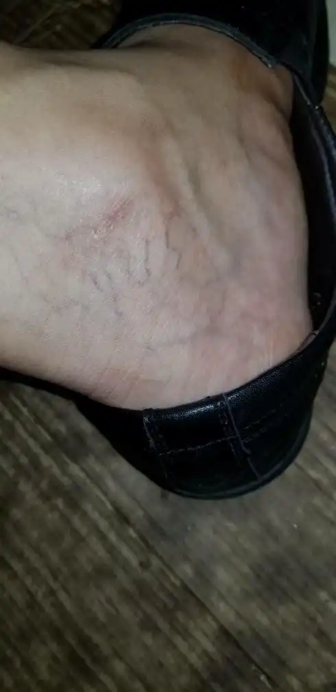 脚出现青经是正常的吗