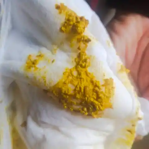 请问刚出生的宝宝奶粉喂养,拉的臭臭这样正常吗