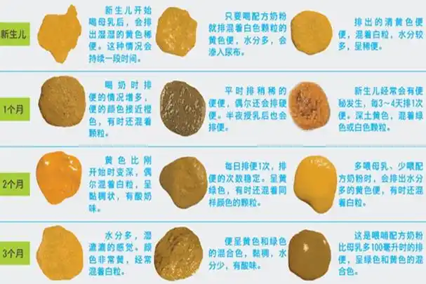 婴儿拉肚子的大便图片(宝宝的便便) - 赤虎壹号
