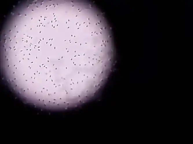 微生物 专业 朋友 帮我看看如下 细菌显微镜下的好氧菌 ,是否是乳杆短