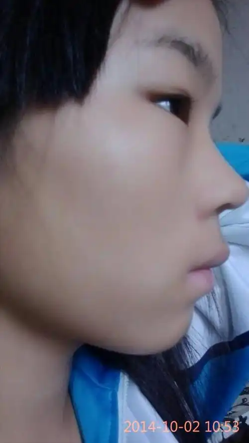 这鼻子属于塌鼻梁吗?