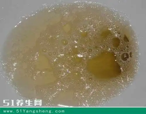 尿液是"粪臭味", 你就危险了, 对照自检一下吧!