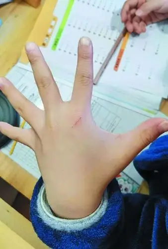 撸猫馆"喵星人"抓伤孩子谁担责?