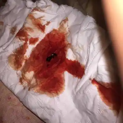 保胎第四天,还是流血,这个正常嘛?