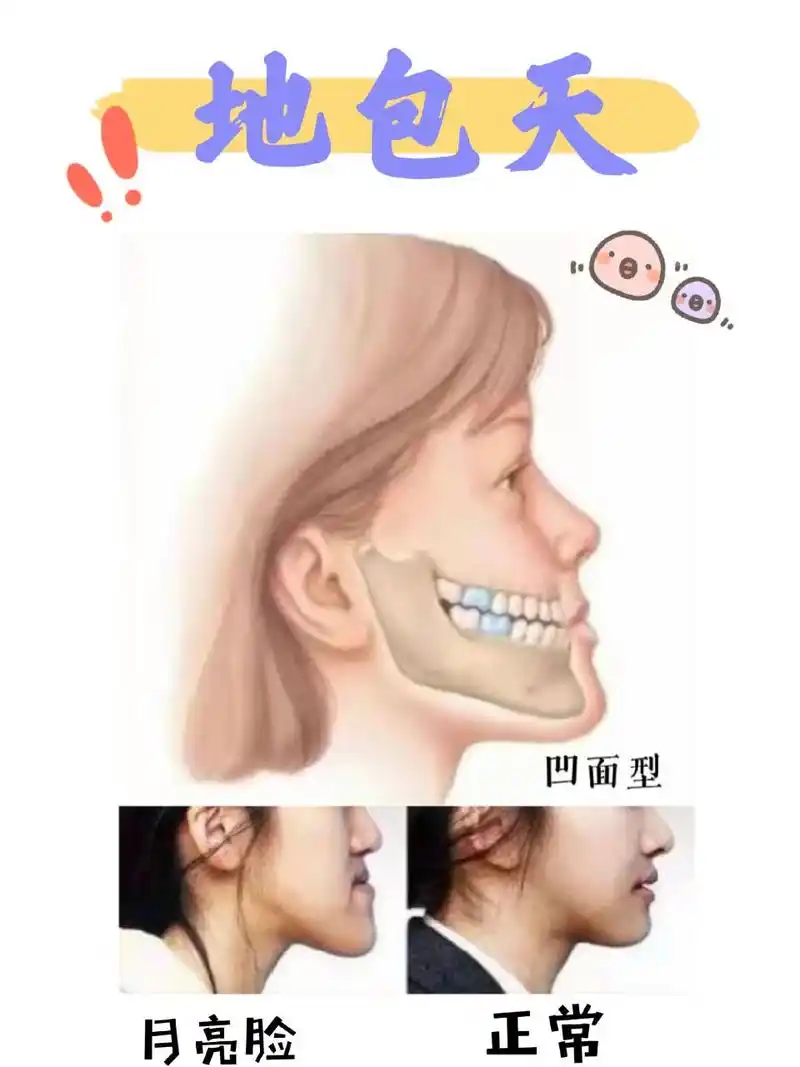 地包天虽然复杂,但我们每个