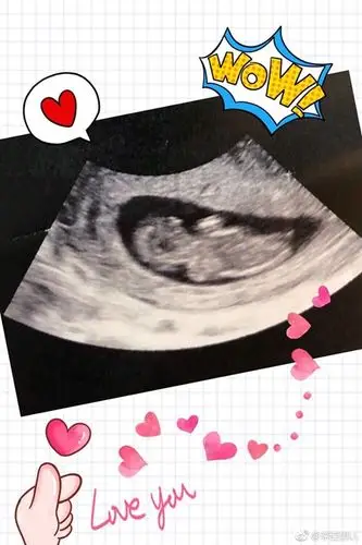 李亚男晒b超照宣布怀孕 王祖蓝:王家有喜