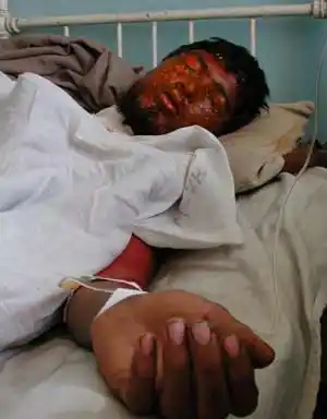 图文:一在10月9日的空袭中受伤的阿富汗人在医院里