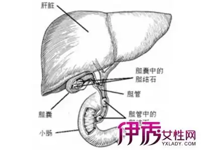 【图】脾大的原因和危害 关注2大病因远离危害