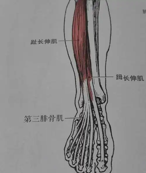 走路姿势不对小腿变形脚还痛松解这2块肌肉缓解不适还瘦腿